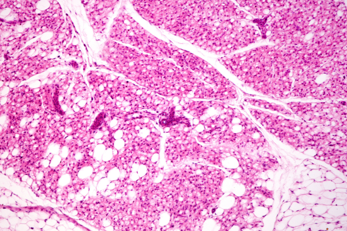 Light micrograph showing interscapular brown adipose (fat) tissue