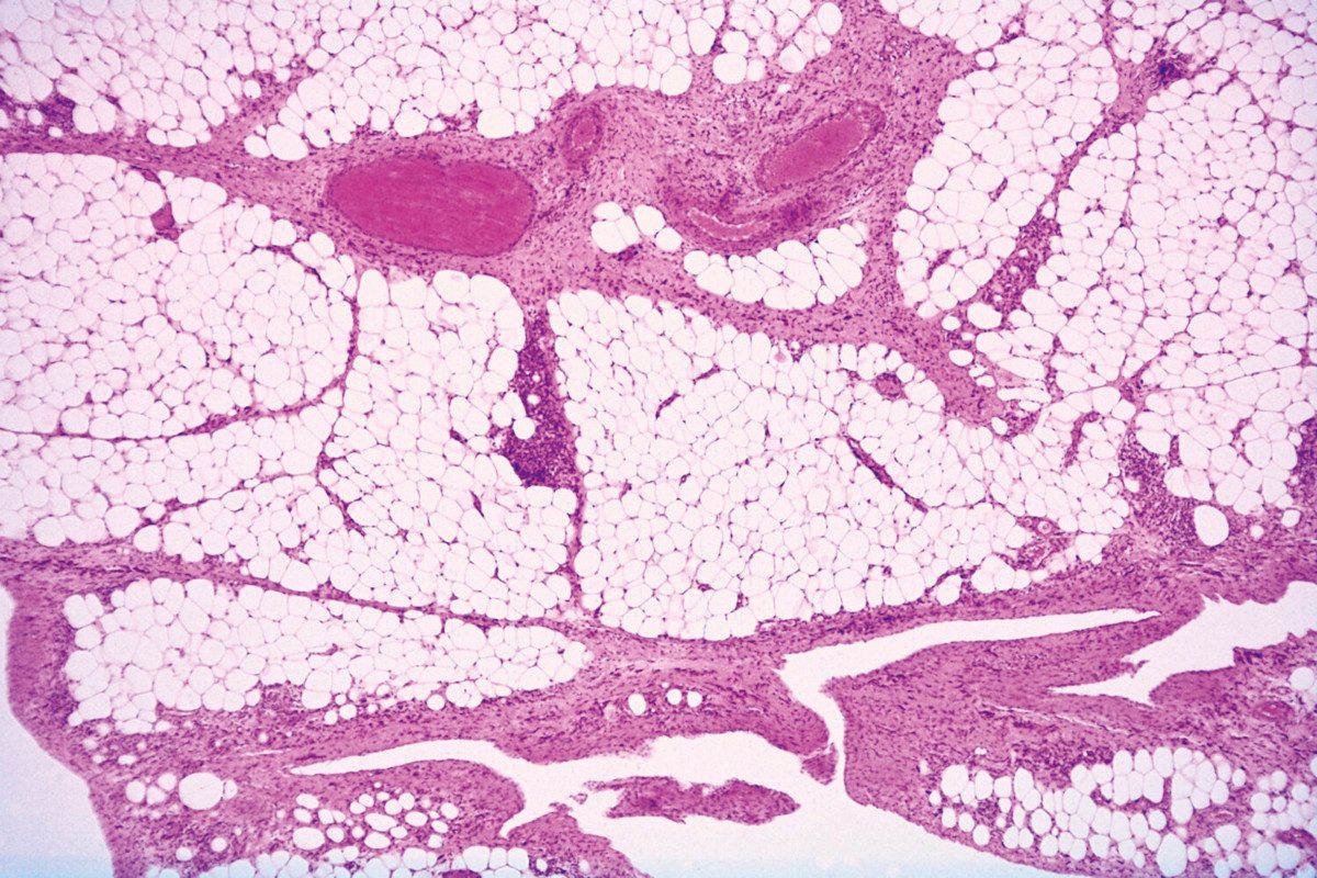 Image of white adipose tissue