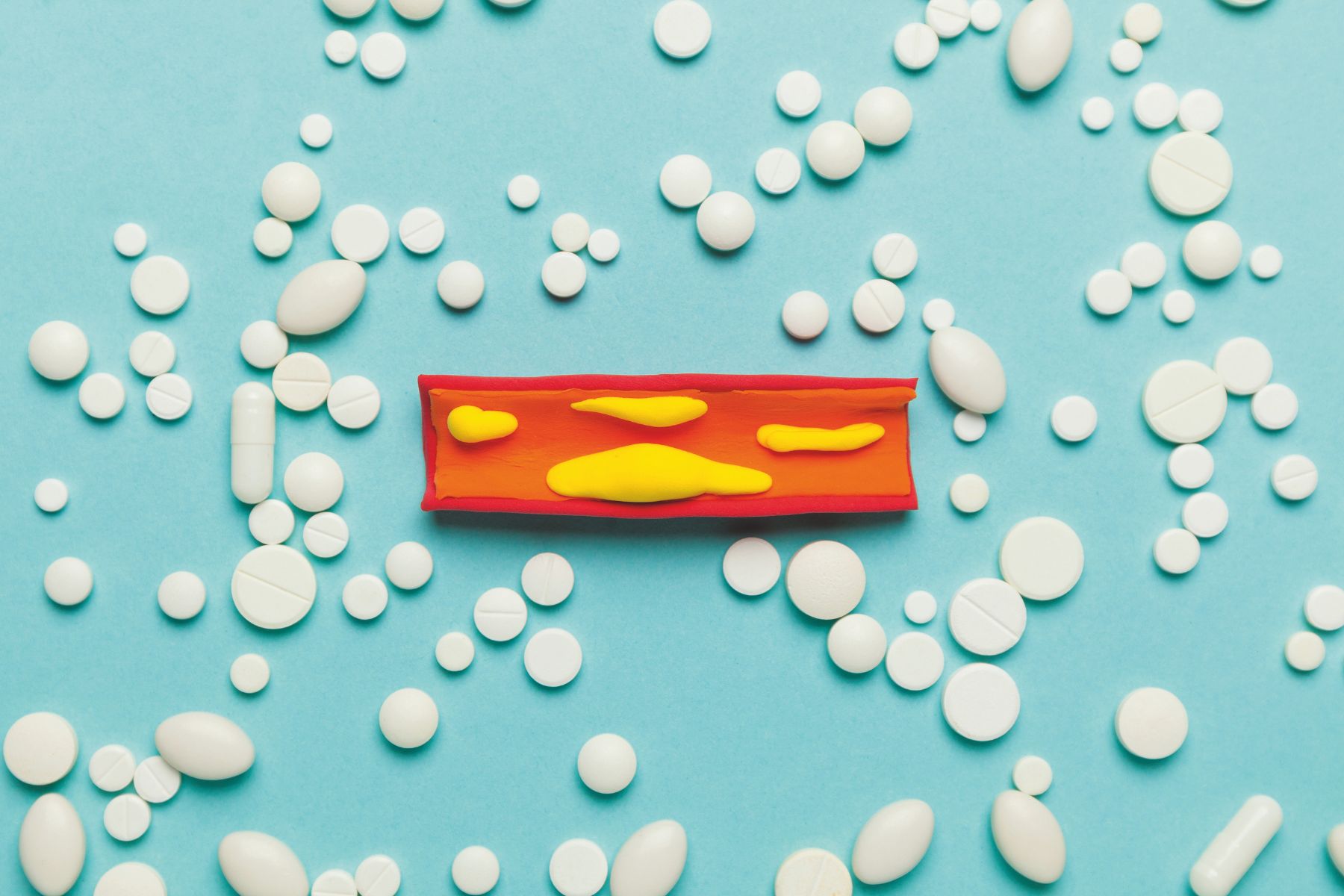 Pills around a model of a blood vessel with plaques inside