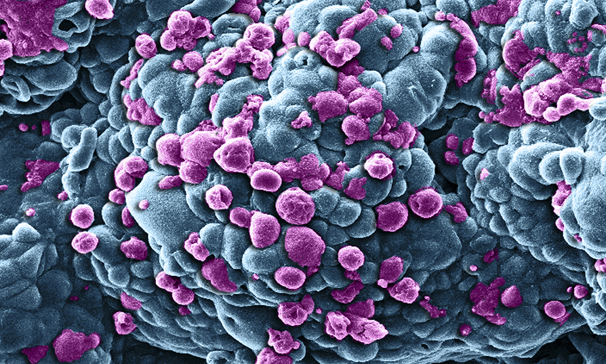 Purple and light blue clusters of cells.