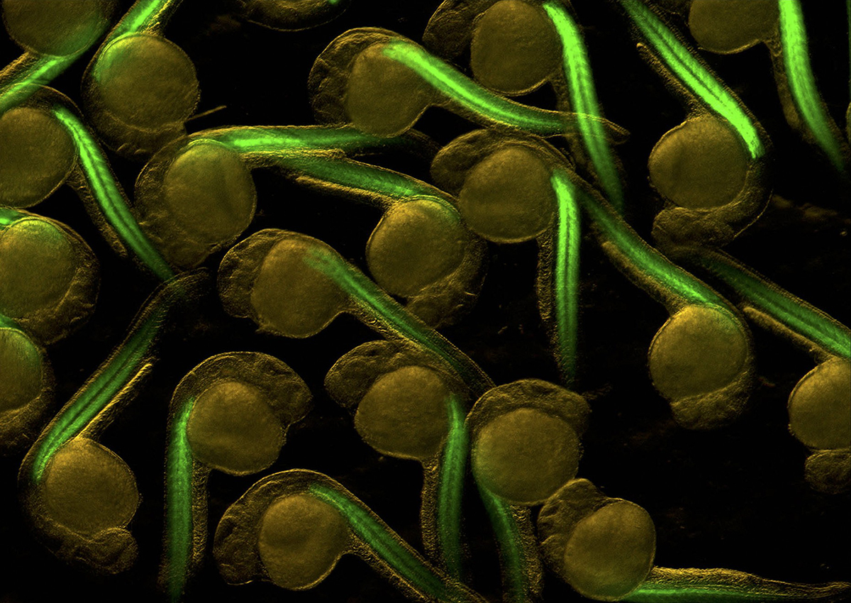 Brown cluster of cells each with green tail.