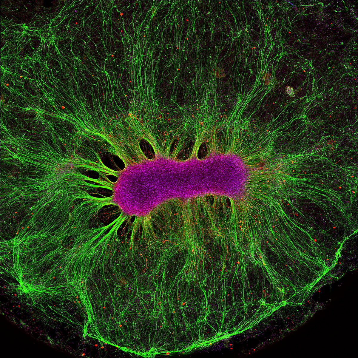 Central purple cluster surrounded by green strands.