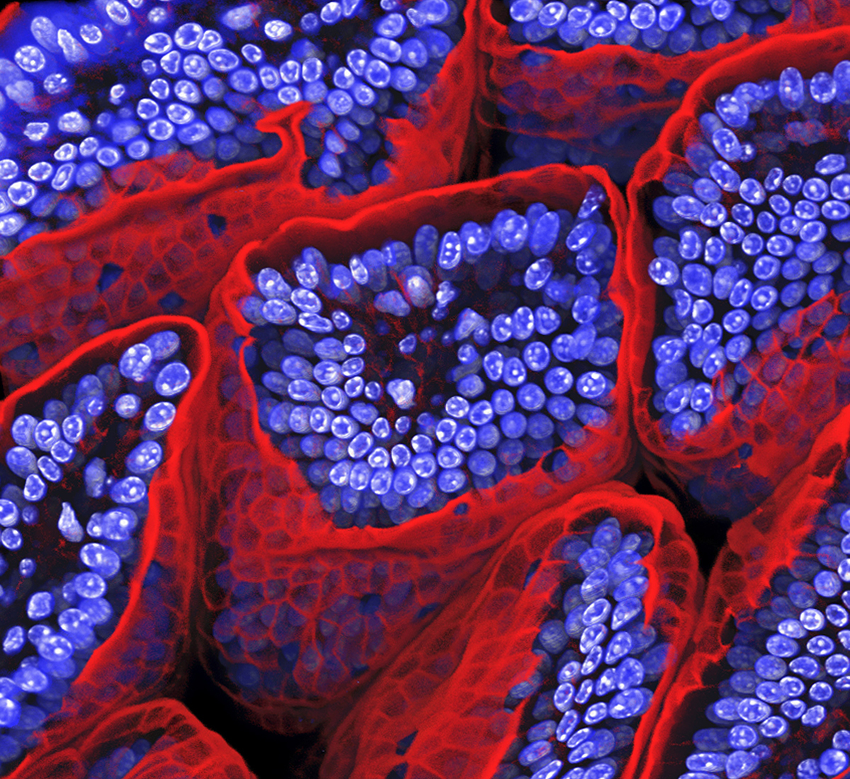 Blue cells surrounded by red cell membranes.