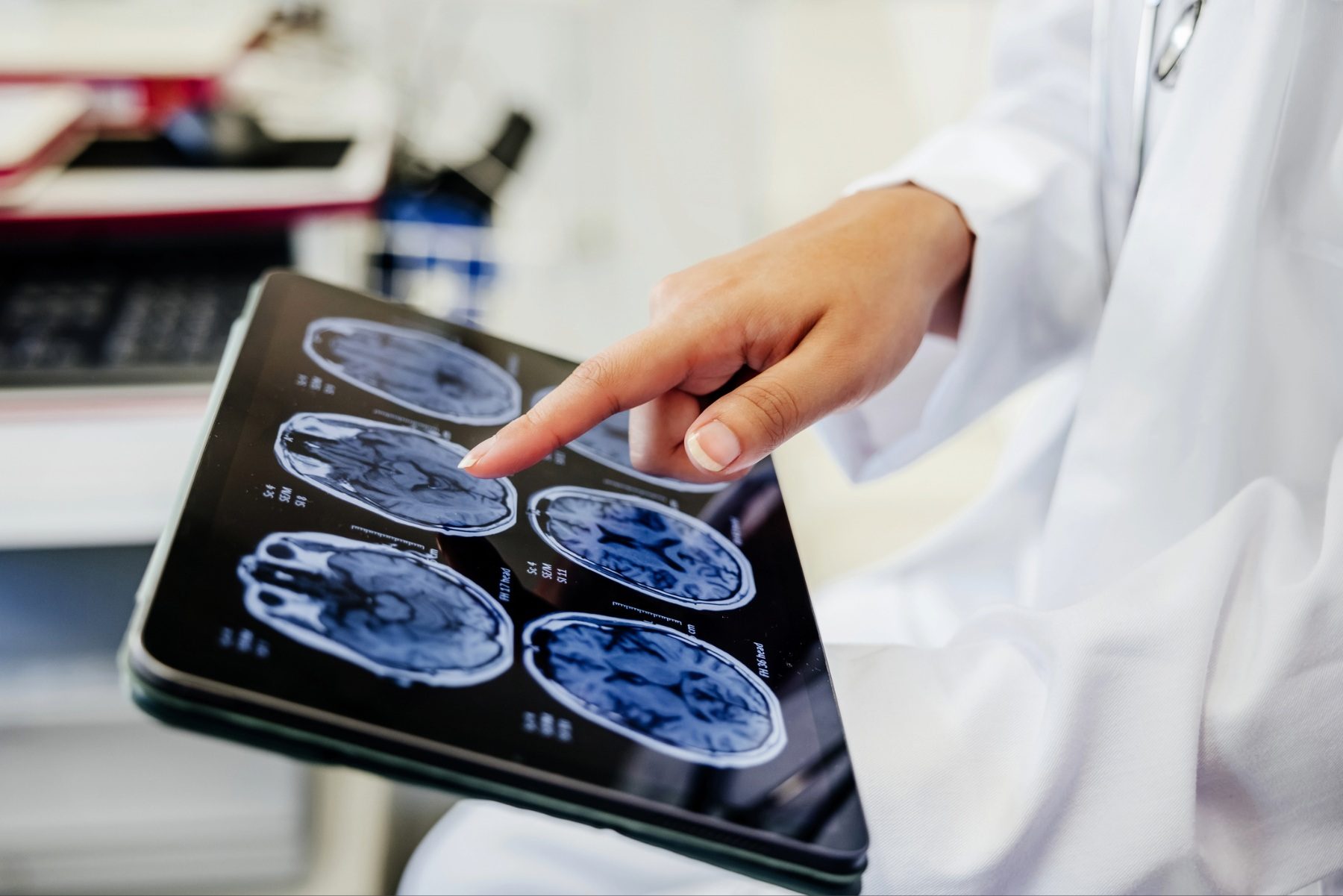Doctor pointing at brain scan