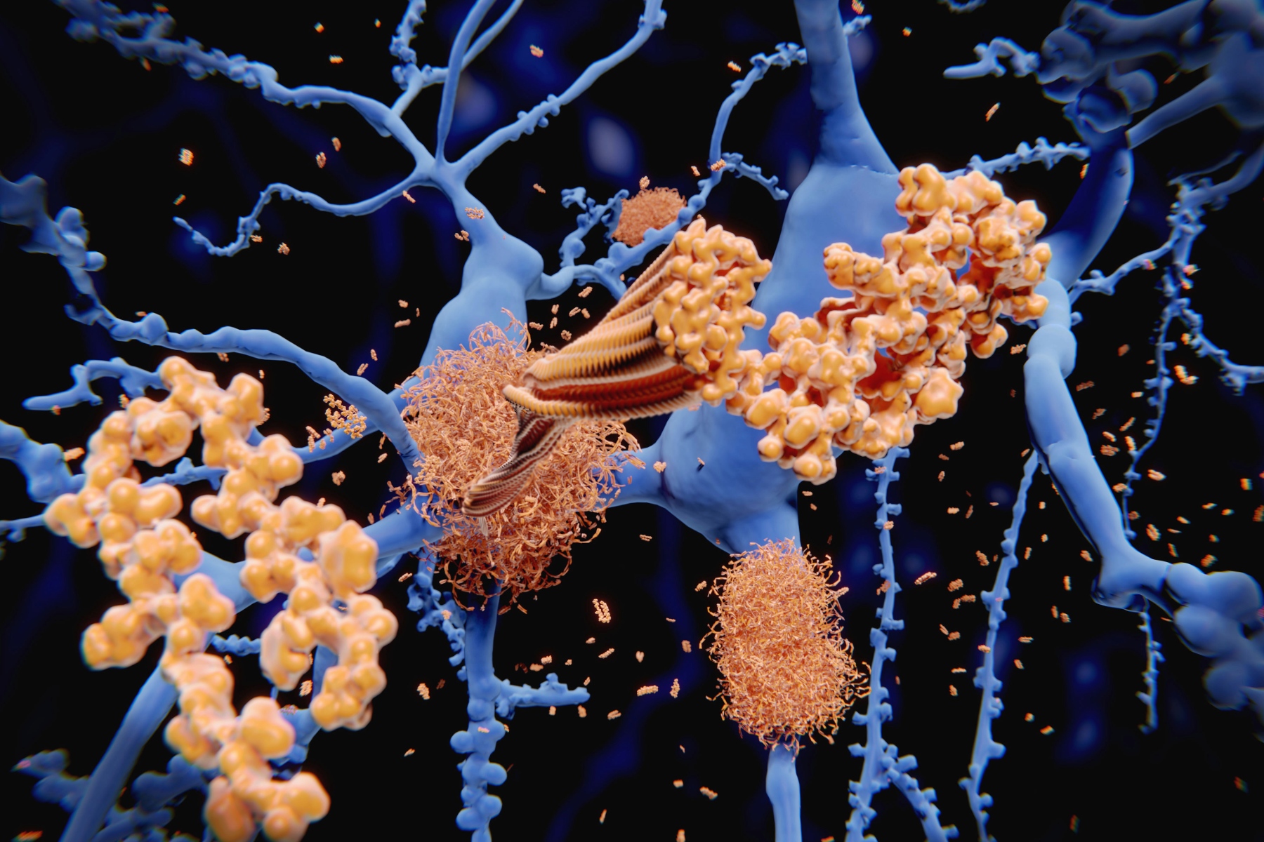 Blobs of protein around neurons