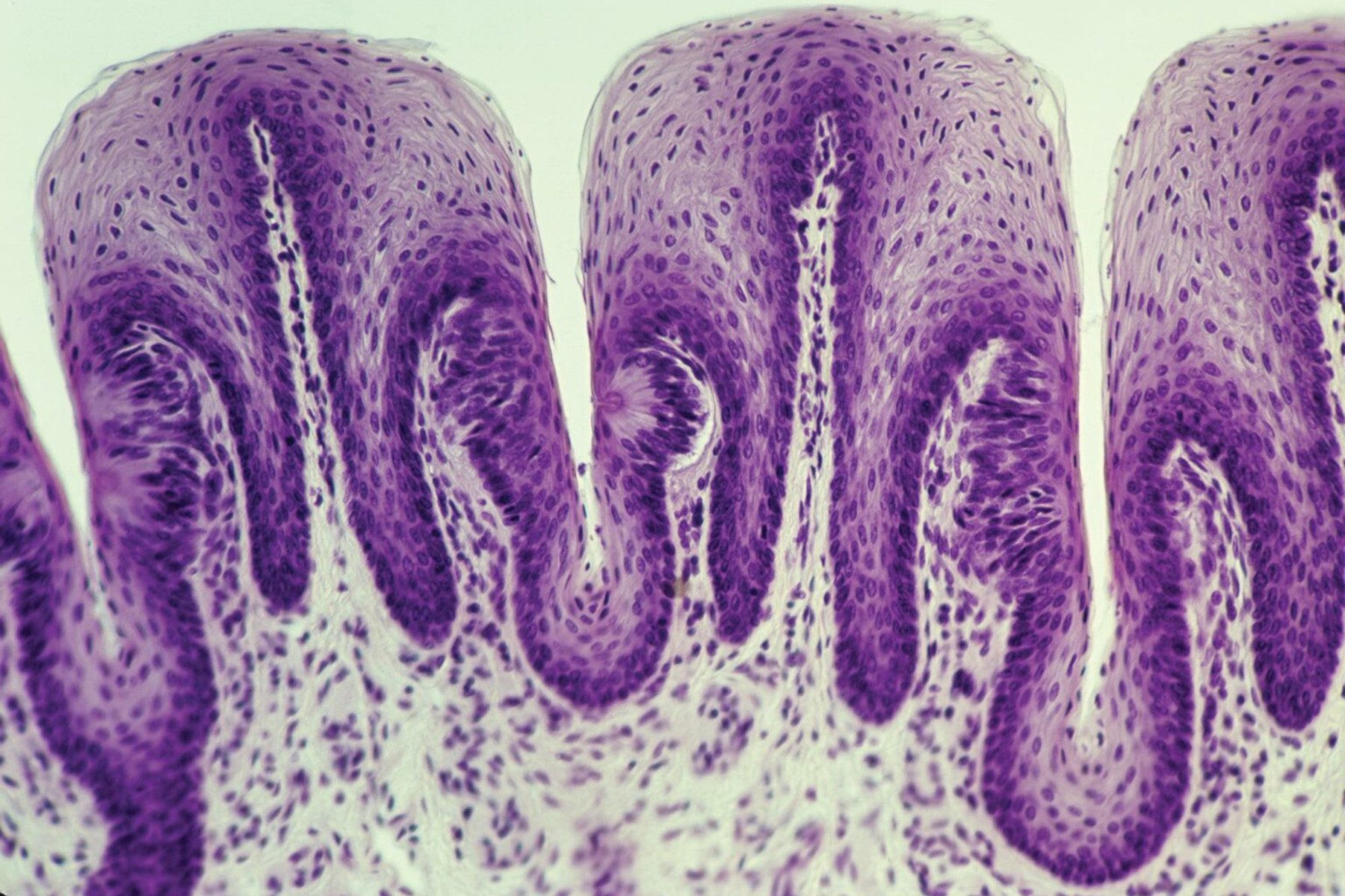 Scan of taste buds
