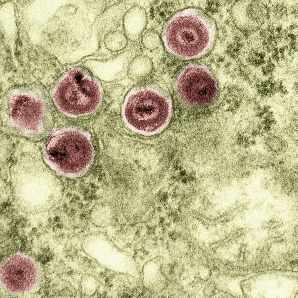A highly magnified image of a cytomegalovirus