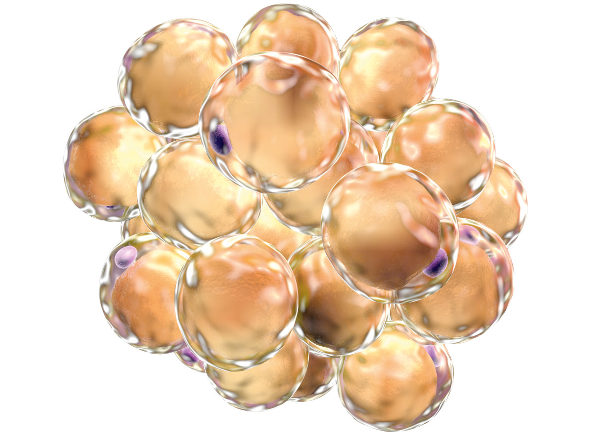 Computer illustration of fat cells