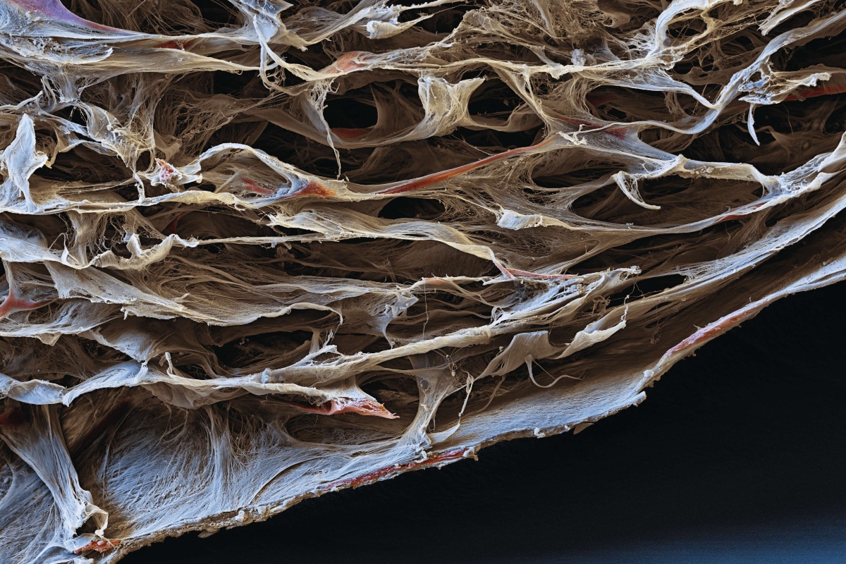 A close-up of bone marrow stem cells