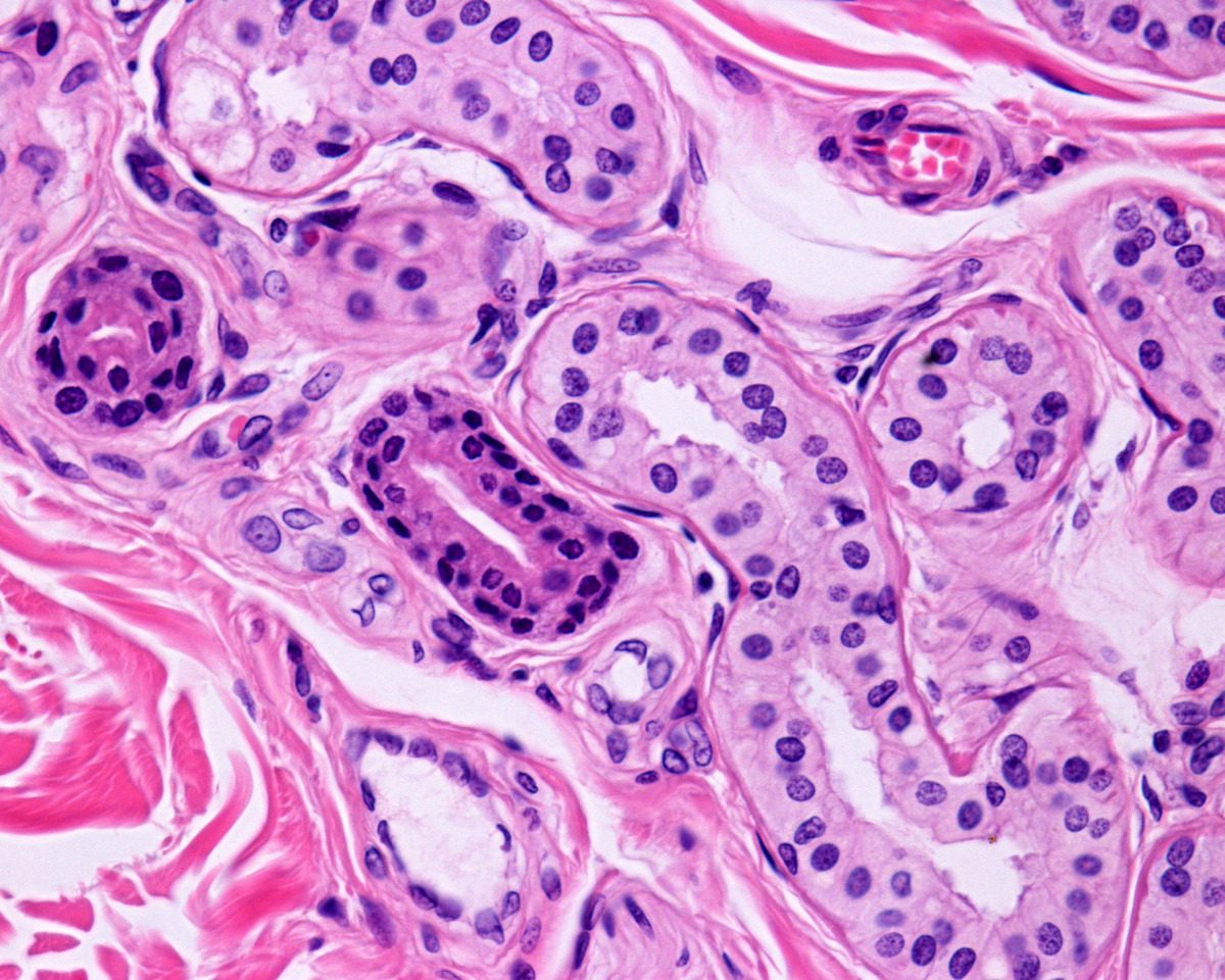 Light micrograph of a secretory unit showing sections of secretory portion lined by a pseudostratified epithelium with pale and dark cells and myoepithelial cells appearing as an eosinophilic border located on the periphery of secretory portions. On the left side, there are two sections of the excretory duct, smaller and darker than the secretory portion of the gland.