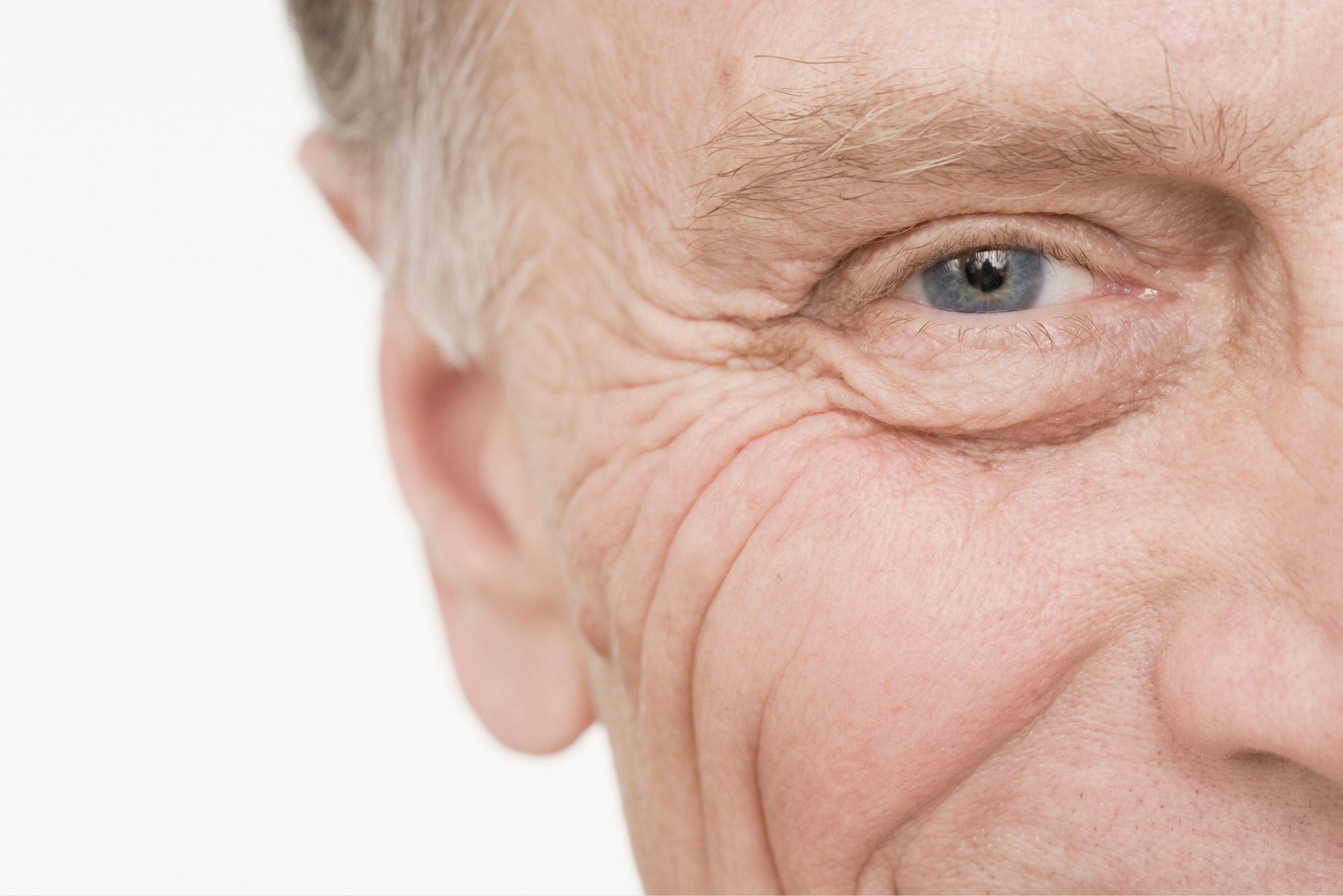 Man with wrinkles around his eyes
