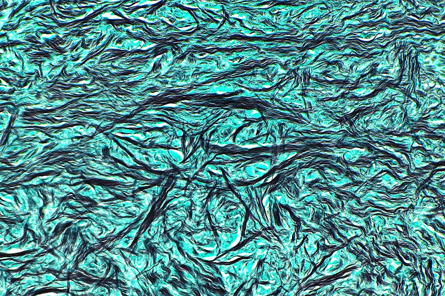 Collagen fibres