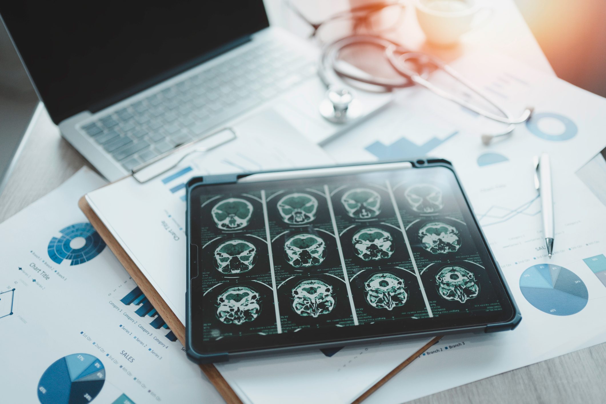 Close-up of a digital tablet with brain x-ray on screen.