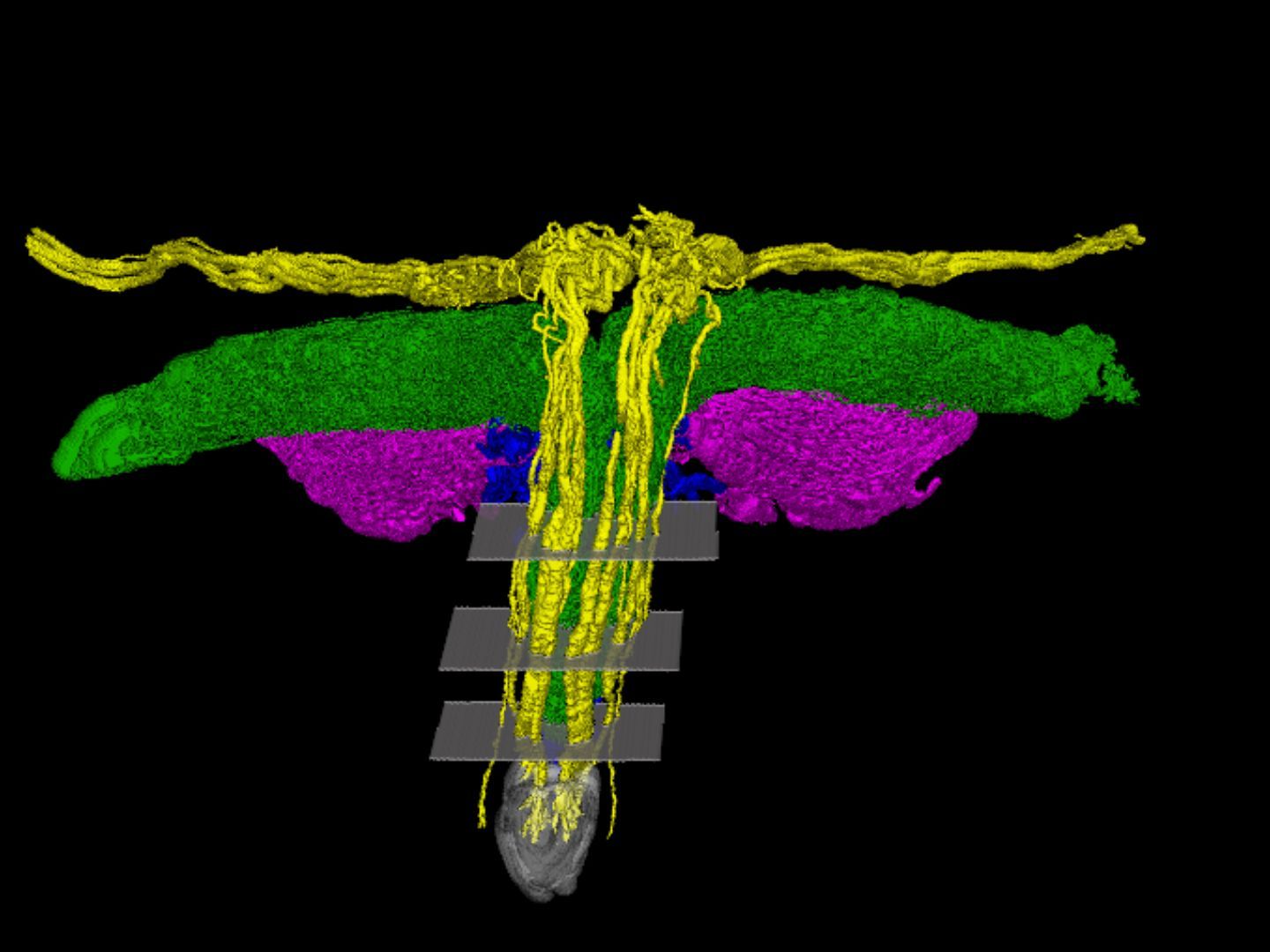 Yellow nerves in a T shape, alongside wings of green and pink below them