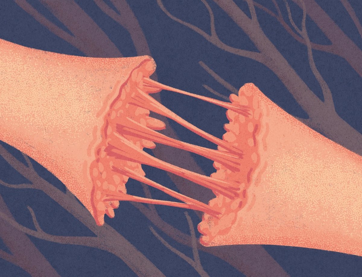 Damaged Vagus Nerve Illustration